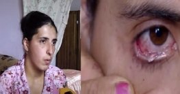 কাঁদলেই চোখ থেকে বের হয় কাচের টুকরো! (ভিডিও)