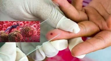 ম্যালেরিয়া রোগটি যেভাবে প্রাণঘাতী হয়ে উঠলো