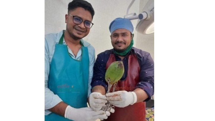 যেভাবে যুবকের পায়ুপথে ৬ ইঞ্চি ডাব, সফল অ*স্ত্রোপচার যেভাবে যুবকের পায়ুপথে ৬ ইঞ্চি ডাব, সফল অ*স্ত্রোপচার
