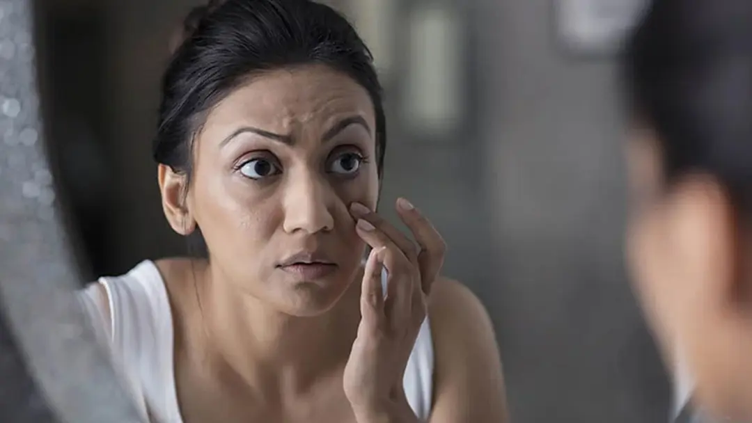 চোখের কোণেই লুকিয়ে রয়েছে ফ্যাটি ‍লিভারের লক্ষণ